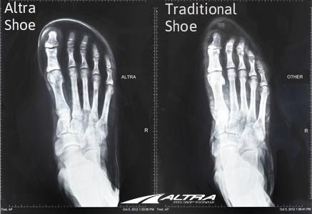 shoe x-ray.jpeg